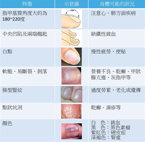 手指指甲病變